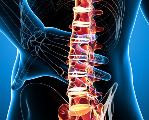 News-physiospain-bad-back